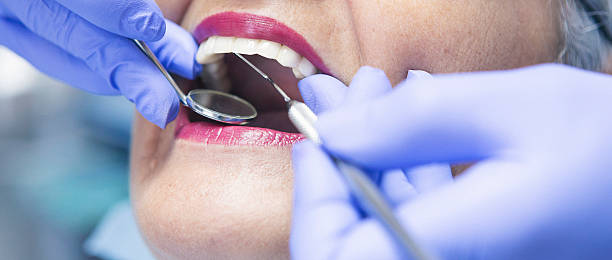 Best Urgent Care for Lost Fillings or Crowns in St Pete Beach, FL